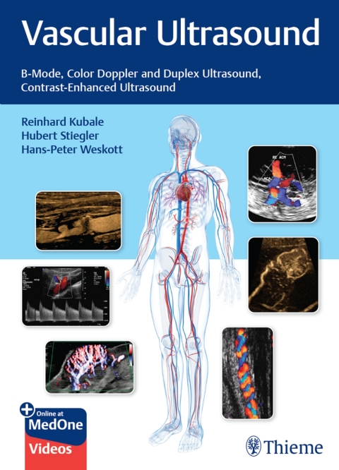 Cover image for book Vascular Ultrasound