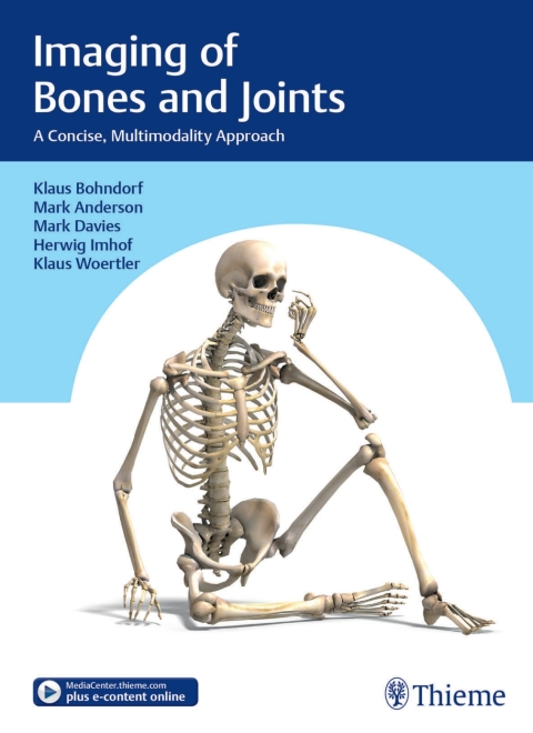 Cover image for book Imaging of Bones and Joints