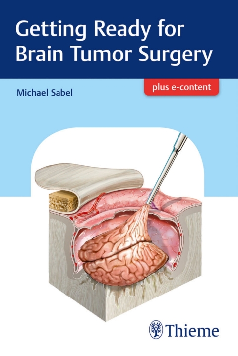 Cover image for book Getting Ready for Brain Tumor Surgery