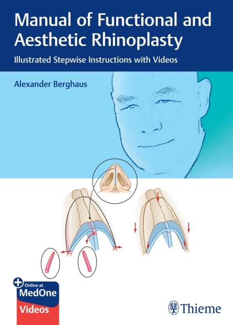 Cover image for book Manual of Functional and Aesthetic Rhinoplasty
