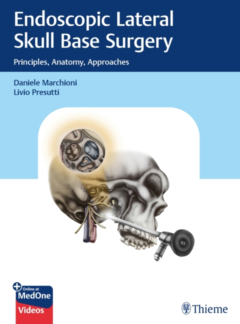 Cover image for book Endoscopic Lateral Skull Base Surgery
