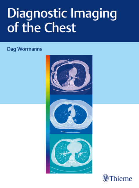 Cover image for book Diagnostic Imaging of the Chest