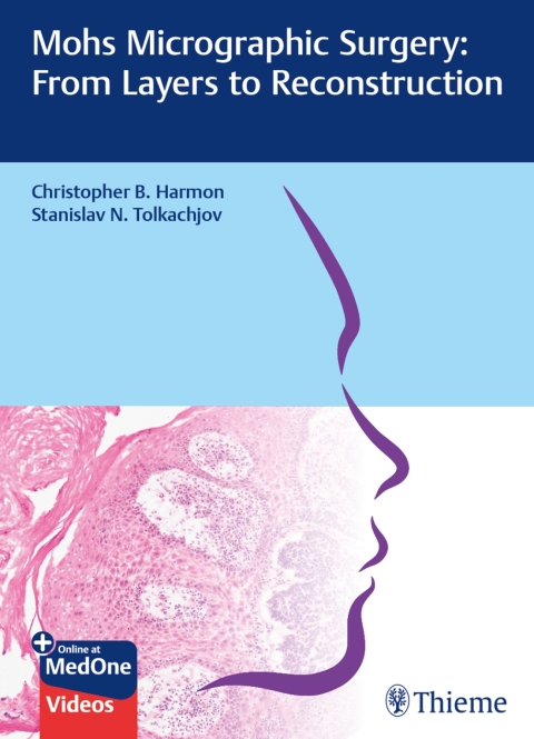 Cover image for book Mohs Micrographic Surgery: From Layers to Reconstruction