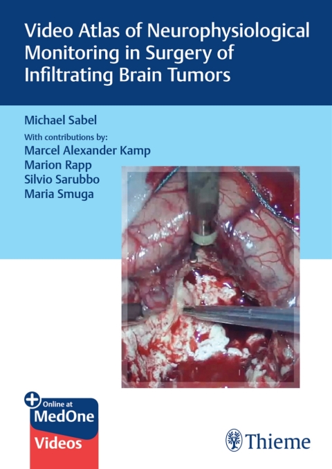 Cover image for book Video Atlas of Neurophysiological Monitoring in Surgery of Infiltrating Brain Tumors