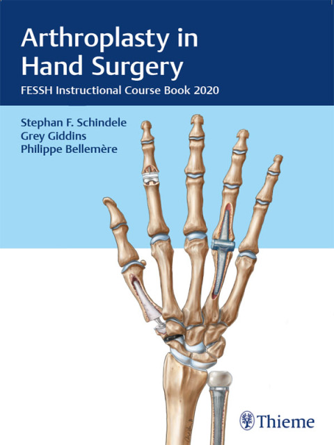 Cover image for book Arthroplasty in Hand Surgery