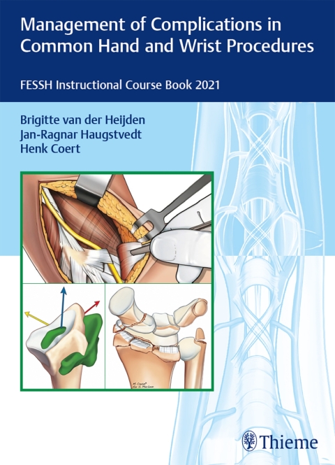 Cover image for book Management of Complications in Common Hand and Wrist Procedures