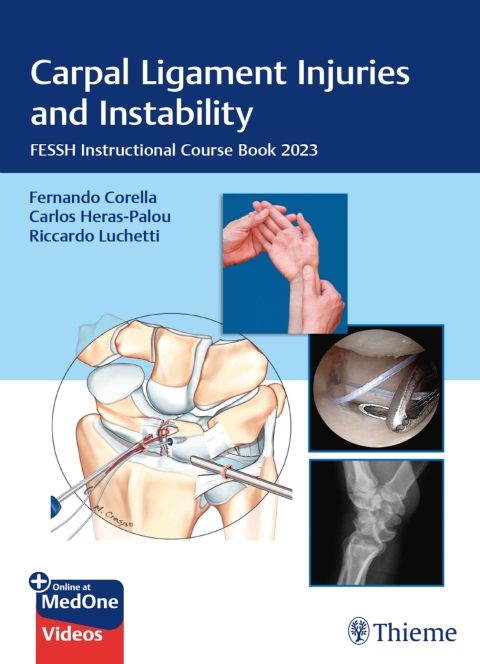 Cover image for book Carpal Ligament Injuries and Instability