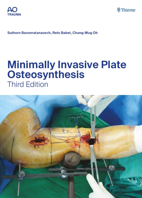 Cover image for book Minimally Invasive Plate Osteosynthesis