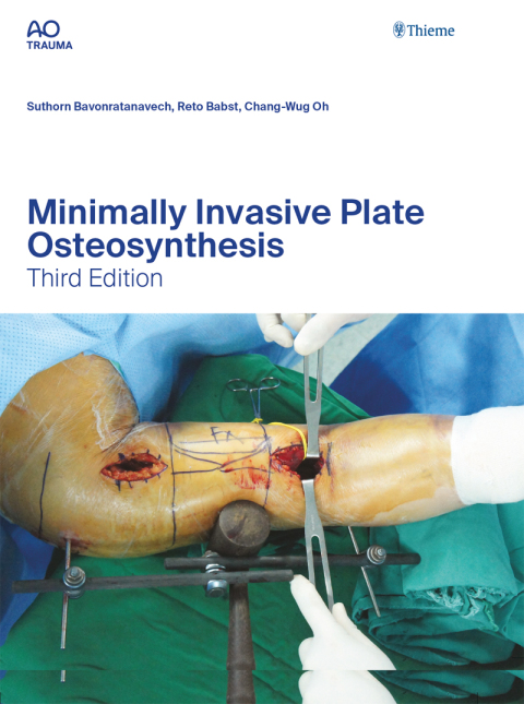 Cover image for book Minimally Invasive Plate Osteosynthesis