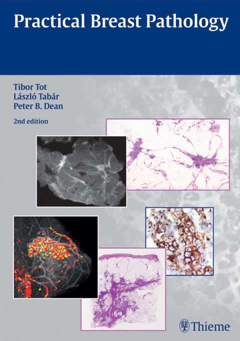 Cover image for book Practical Breast Pathology