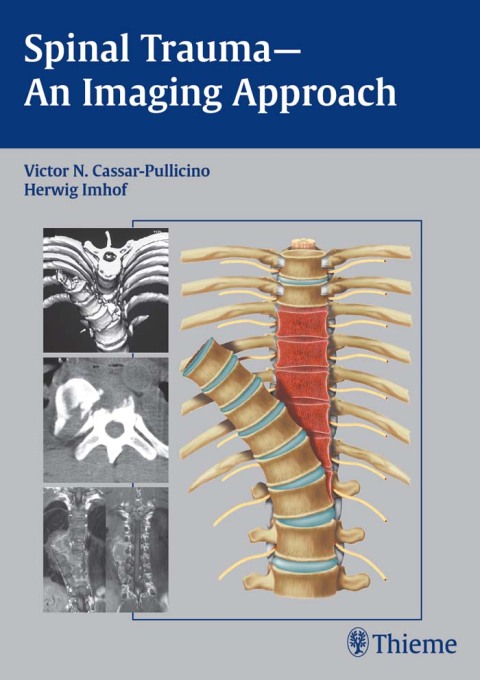 Cover image for book Spinal Trauma - An Imaging Approach