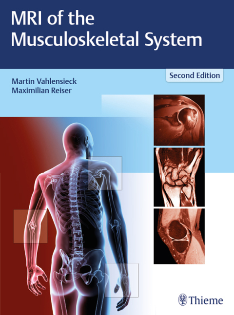 Cover image for book MRI of the Musculoskeletal System