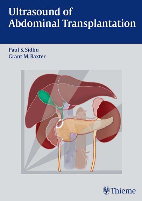 Ultrasound of Abdominal Transplantation 