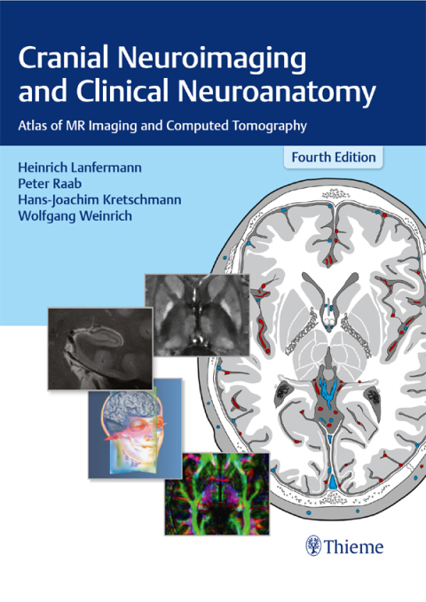 Cranial Neuroimaging and Clinical Neuroanatomy 