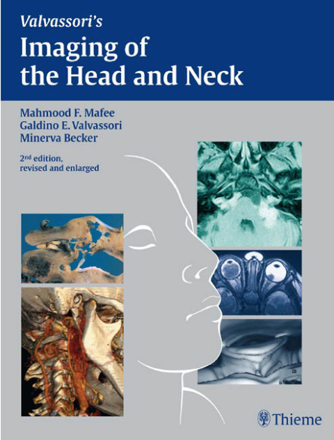 Cover image for book Imaging of the Head and Neck