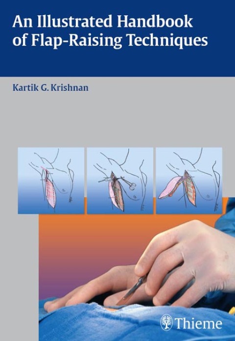Cover image for book An Illustrated Handbook of Flap-Raising Techniques