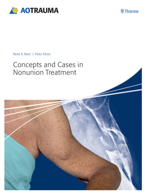 Cover image for book Concepts and Cases in Nonunion Treatment