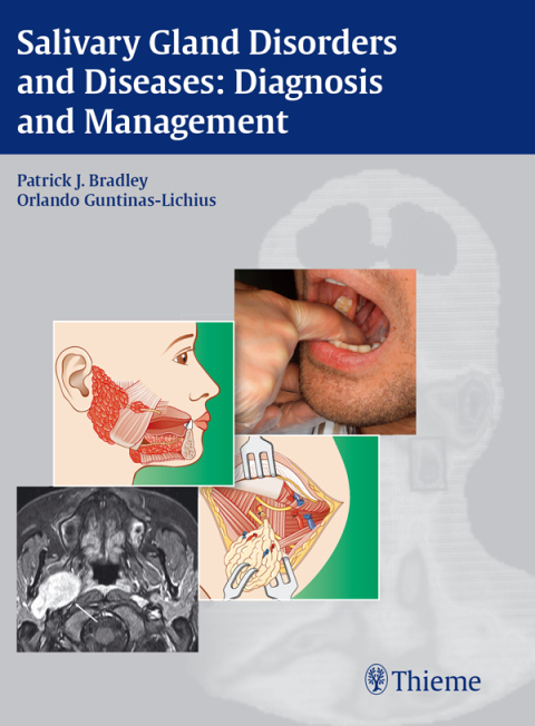 Cover image for book Salivary Gland Disorders and Diseases