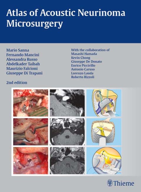 Atlas of Acoustic Neurinoma Microsurgery 