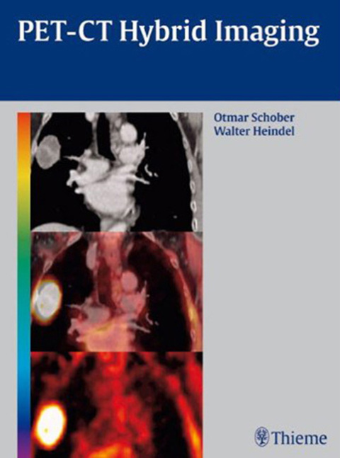 Cover image for book PET-CT Hybrid Imaging