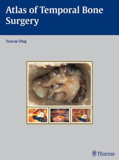 Cover image for book Atlas of Temporal Bone Surgery