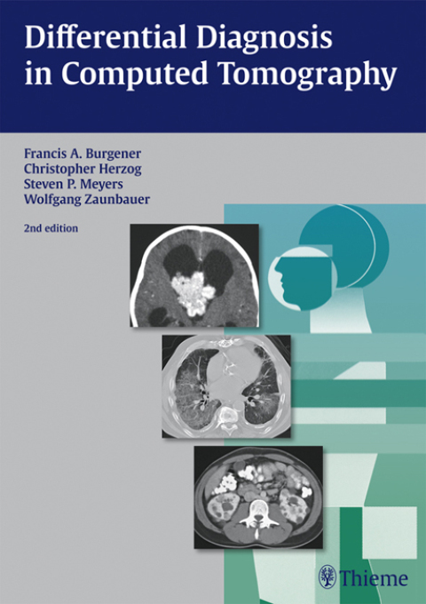 Differential Diagnosis in Computed Tomography 