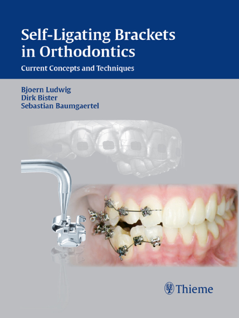 Cover image for book Self-Ligating Brackets in Orthodontics