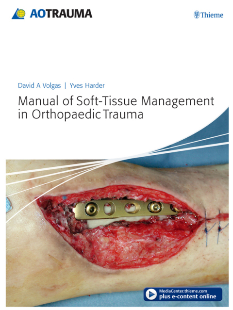 Cover image for book Manual of Soft-Tissue Management in Orthopaedic Trauma