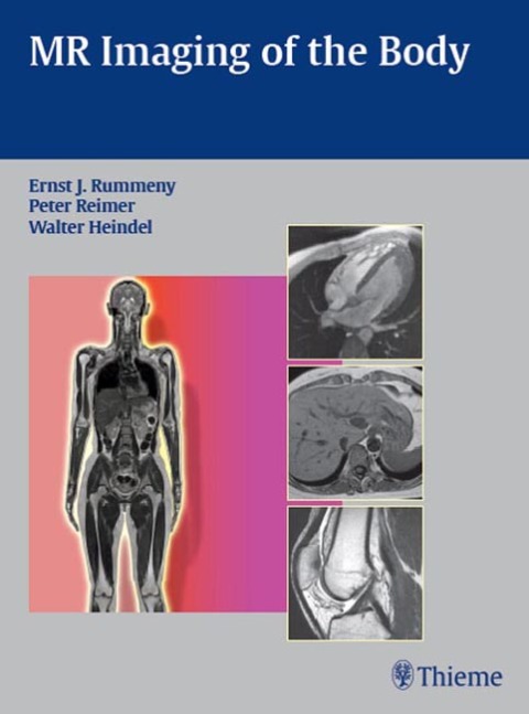 Cover image for book MR Imaging of the Body