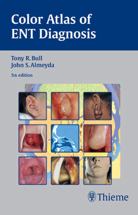 Cover image for book Color Atlas of ENT Diagnosis