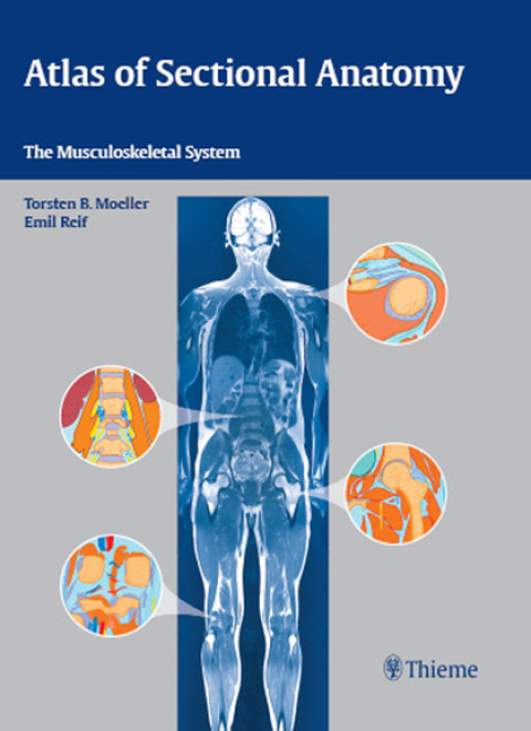 Cover image for book Atlas of Sectional Anatomy