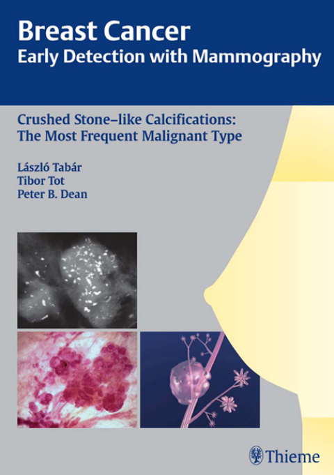 Cover image for book Breast Cancer: Early Detection with Mammography