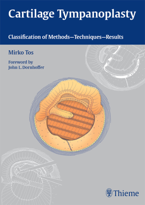 Cover image for book Cartilage Tympanoplasty