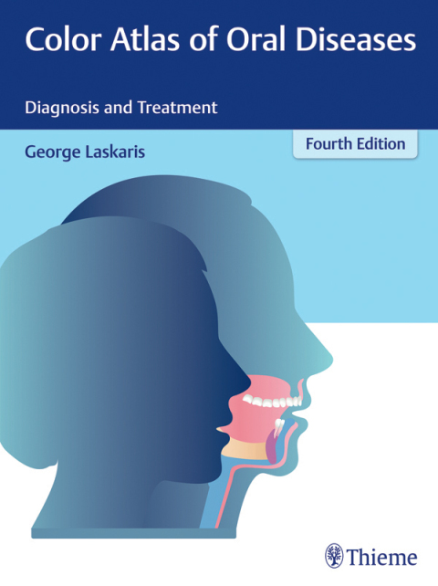 Cover image for book Color Atlas of Oral Diseases