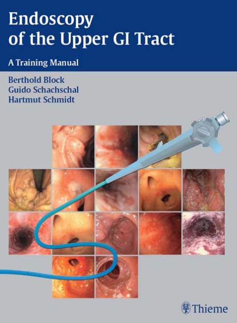 Cover image for book Endoscopy of the Upper GI Tract