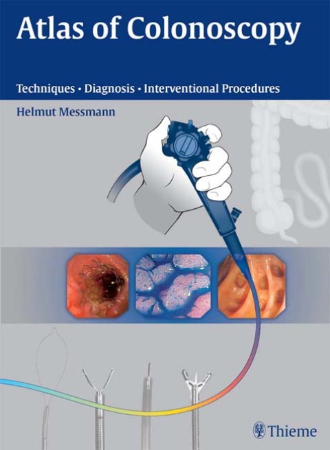 Cover image for book Atlas of Colonoscopy