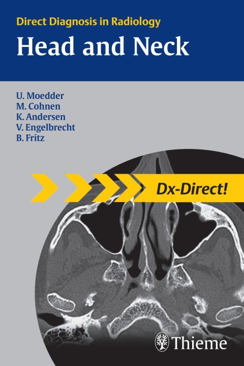 Cover image for book Head and Neck Imaging