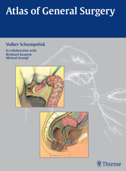 Cover image for book Atlas of General Surgery