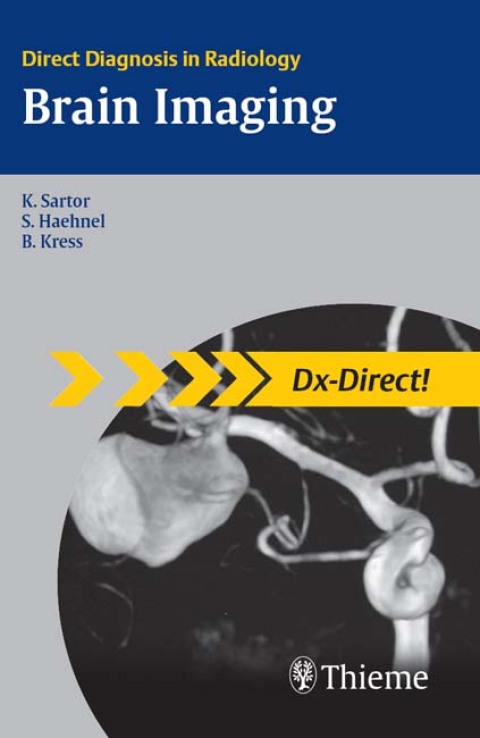 Cover image for book Brain Imaging