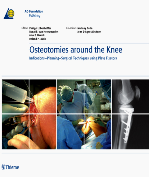 Cover image for book Osteotomies around the Knee