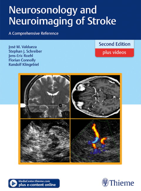 Cover image for book Neurosonology and Neuroimaging of Stroke