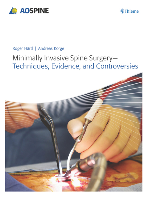 Cover image for book Minimally Invasive Spine Surgery - Techniques, Evidence, and Controversies
