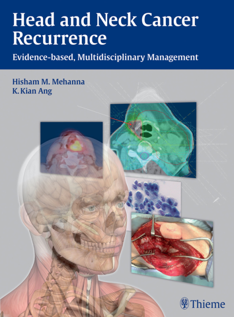 Cover image for book Head and Neck Cancer Recurrence