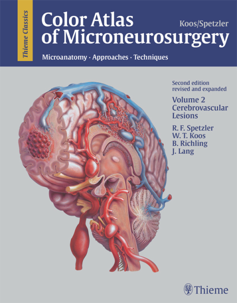Color Atlas of Microneurosurgery: Volume 2 - Cerebrovascular Lesions 