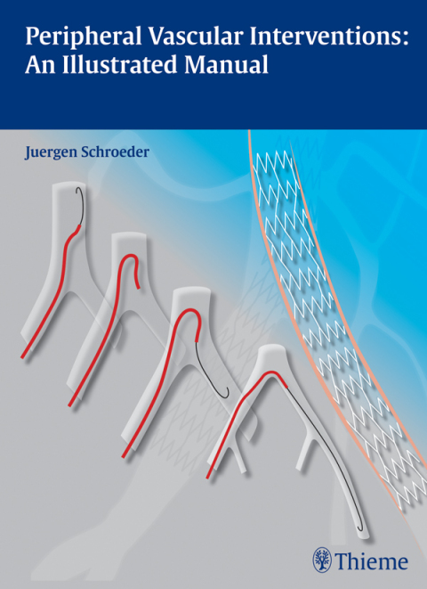 Cover image for book Peripheral Vascular Interventions: An Illustrated Manual