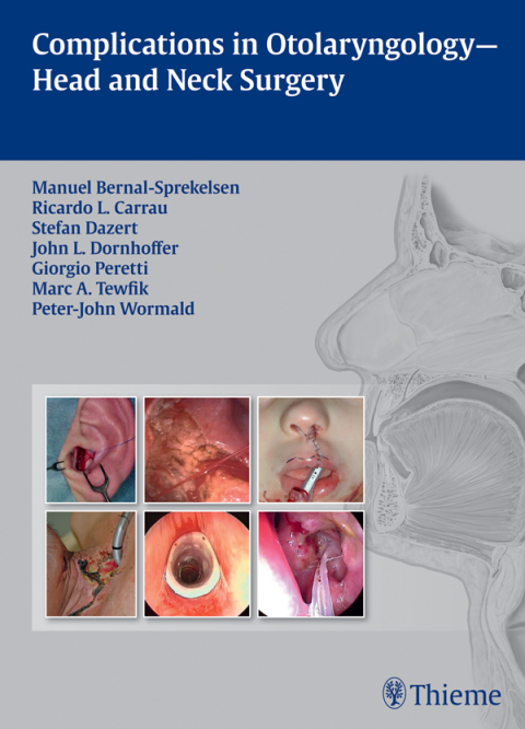Cover image for book Complications in Otolaryngology - Head and Neck Surgery