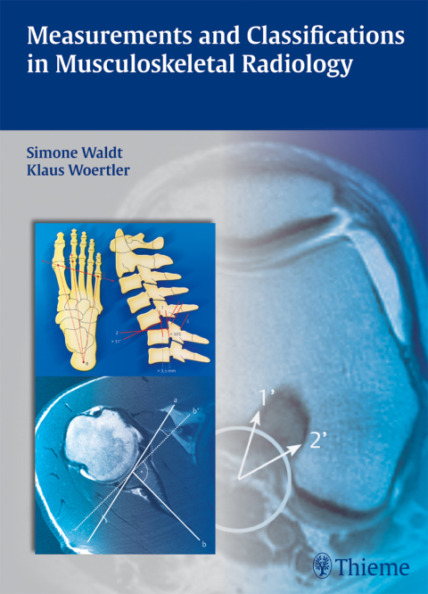 Cover image for book Measurements and Classifications in Musculoskeletal Radiology