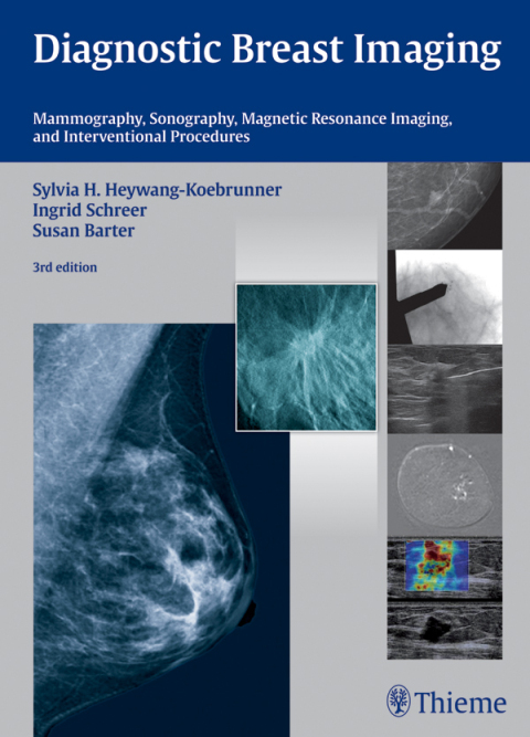 Cover image for book Diagnostic Breast Imaging