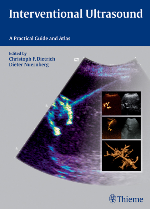 Cover image for book Interventional Ultrasound