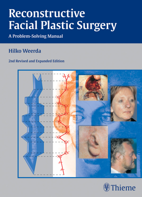 Cover image for book Reconstructive Facial Plastic Surgery